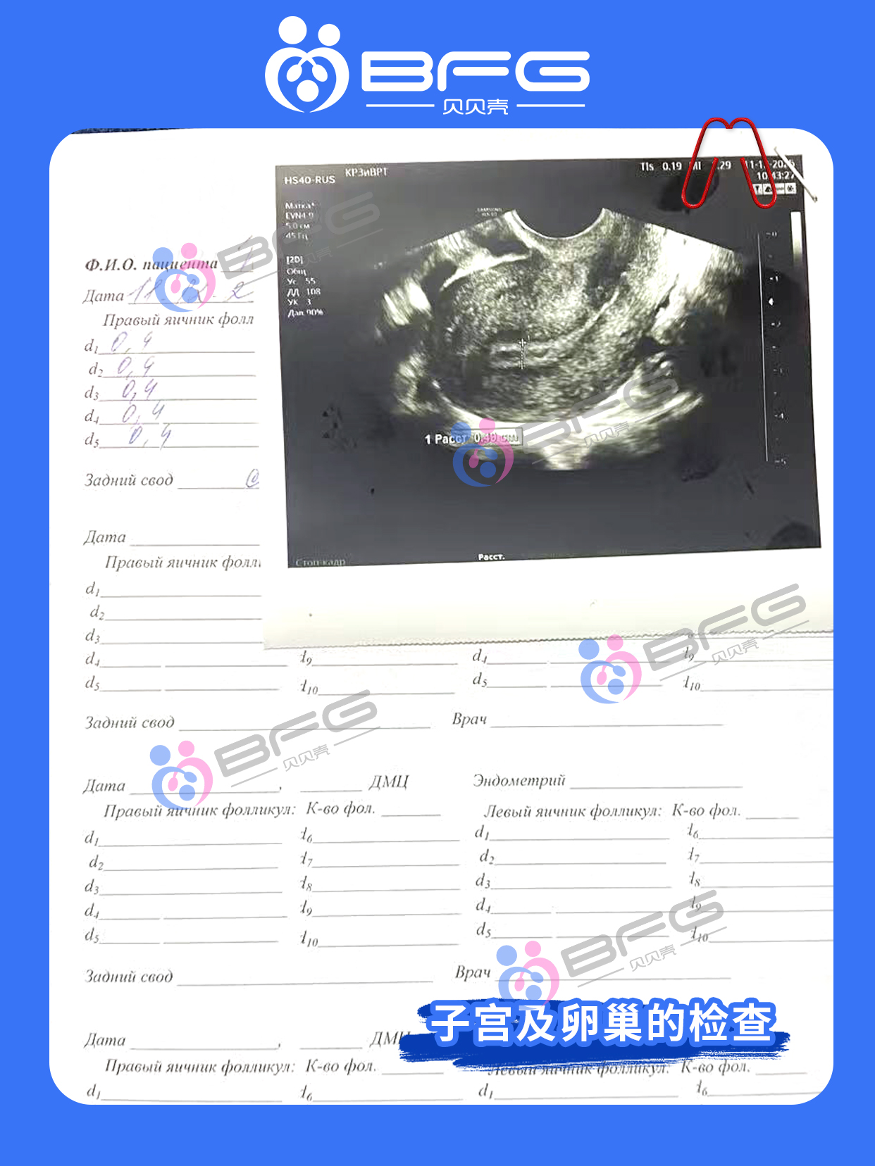 BFG助孕 | ❤妈妈移植前的全面检查