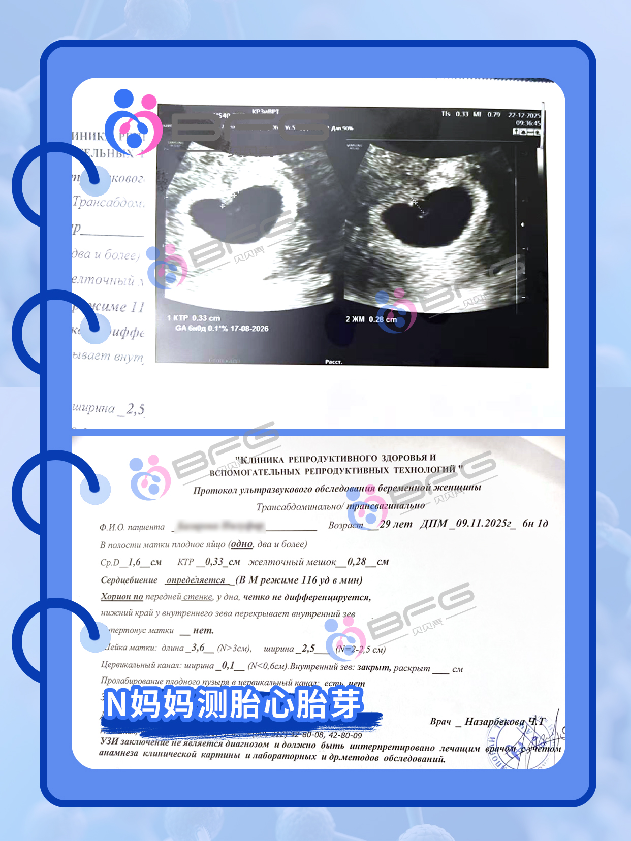 BFG助孕|马騳(dú)骉(biāo)驷，四个家庭圆满