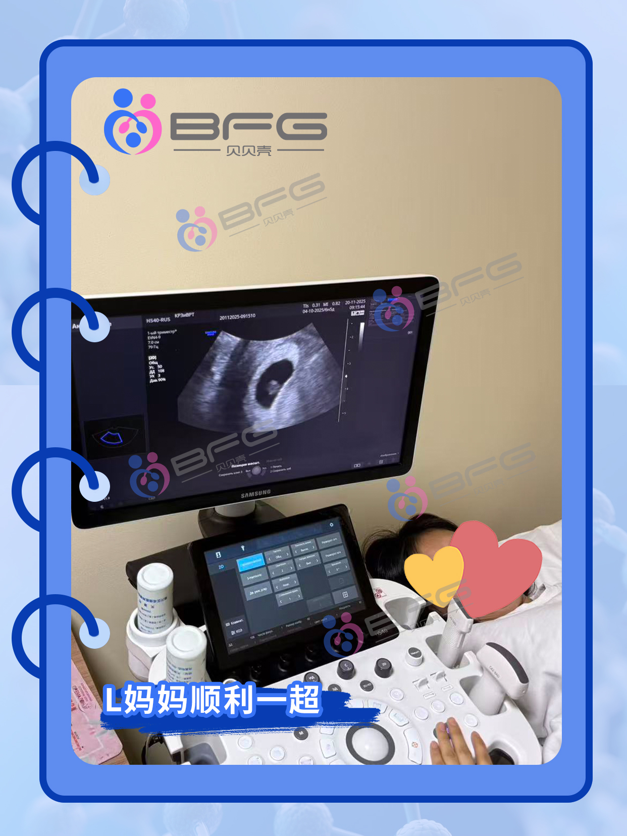 BFG助孕|喜报！2位❥(^_-)妈妈顺利一超/二超