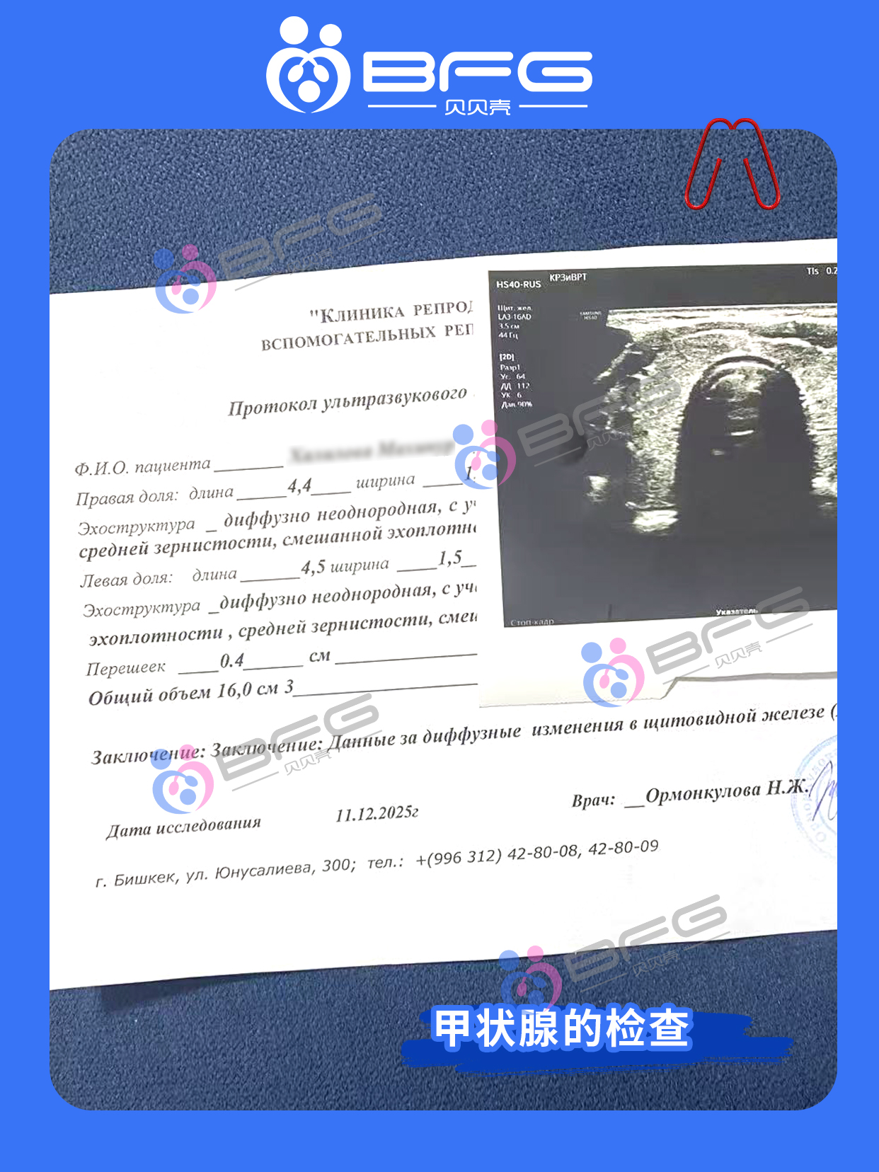 BFG助孕 | ❤妈妈移植前的全面检查