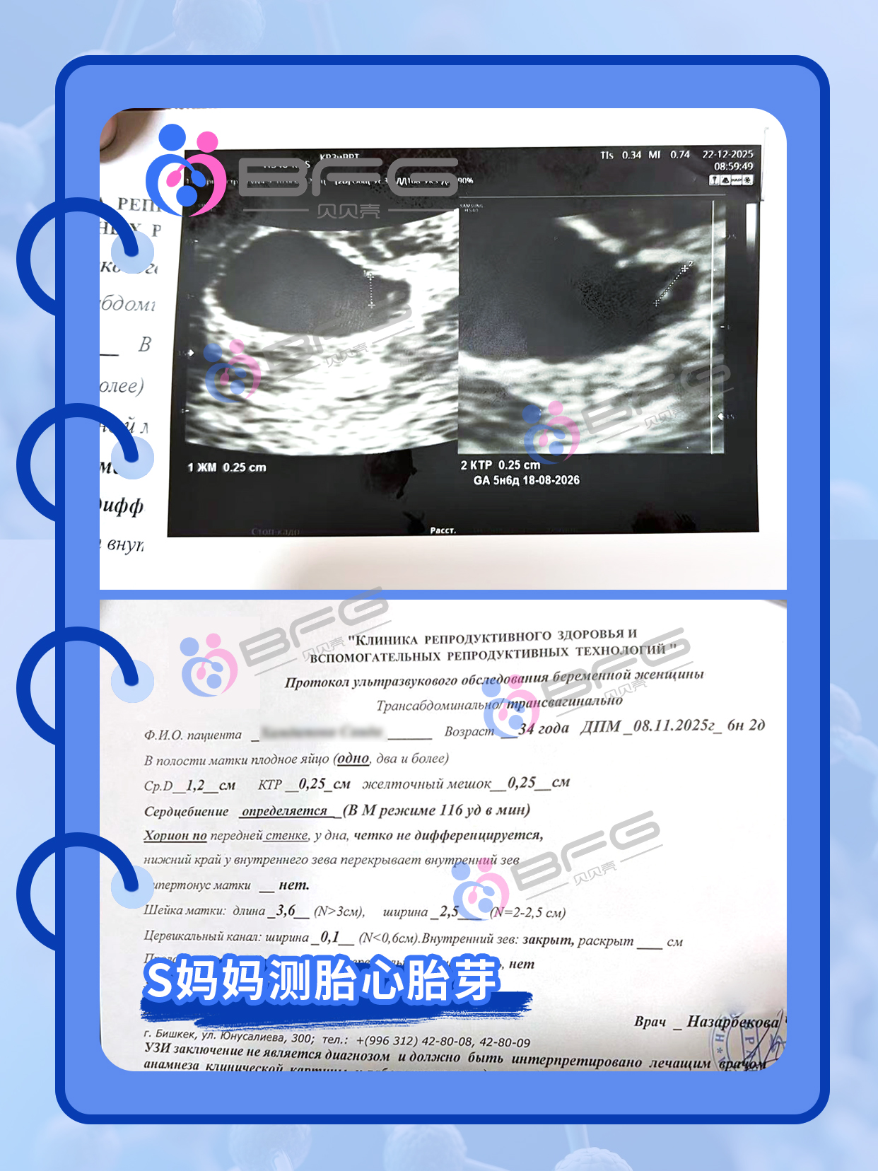 BFG助孕|马騳(dú)骉(biāo)驷，四个家庭圆满