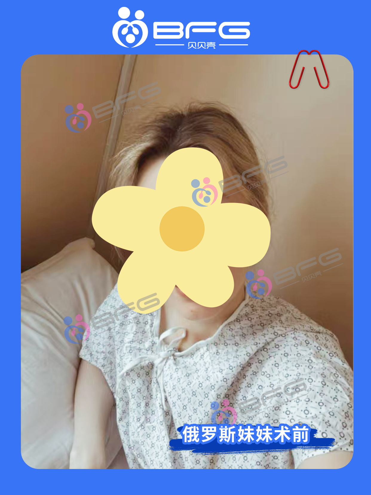 BFG吉国|迎来超可爱的天使混血宝宝