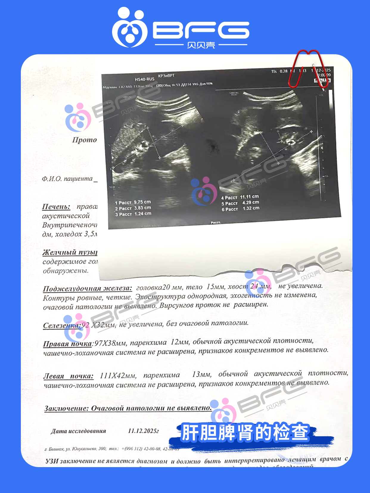 BFG助孕 | ❤妈妈移植前的全面检查