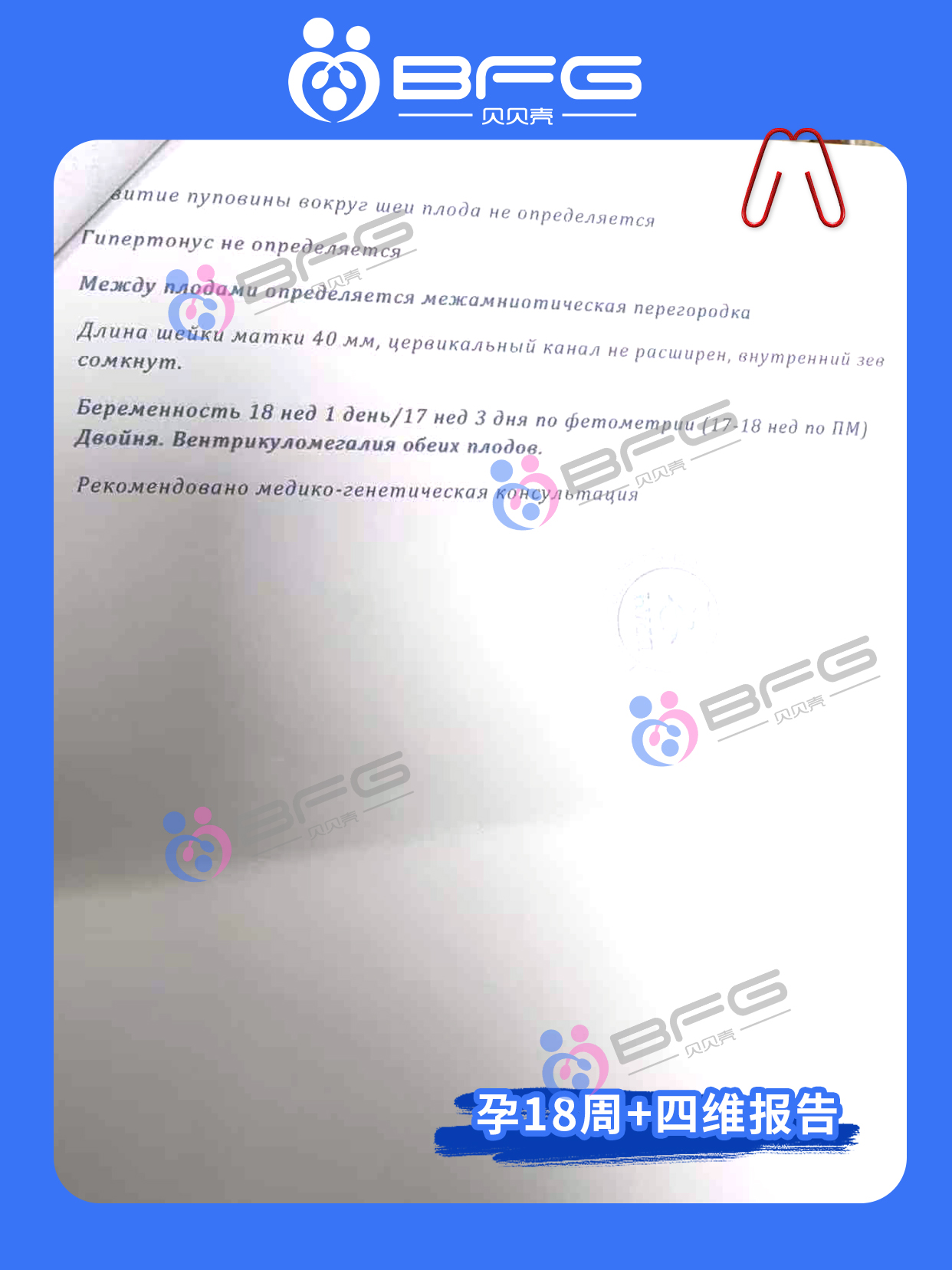 BFG助孕|四维通过，期待与两个宝宝的初见