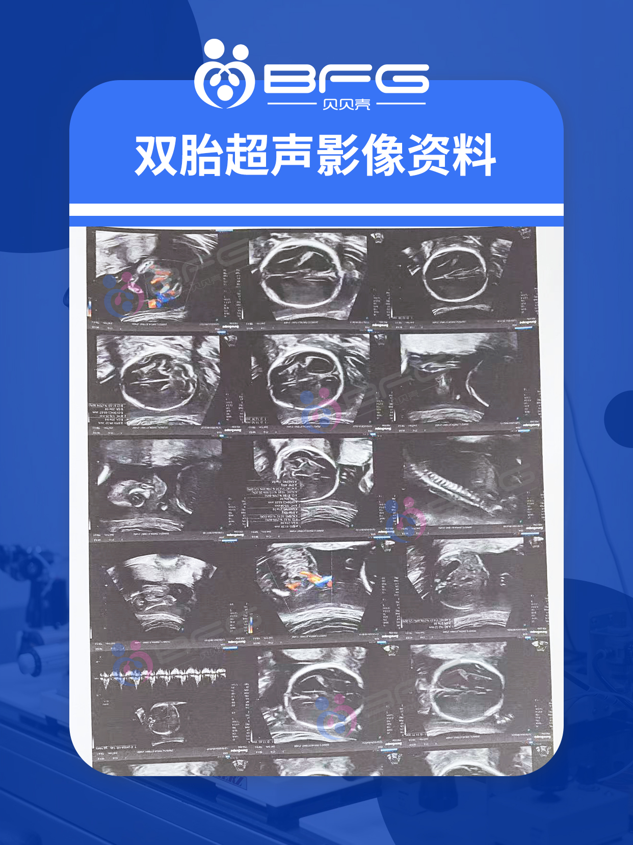 BFG助孕|马+马=騳(du)