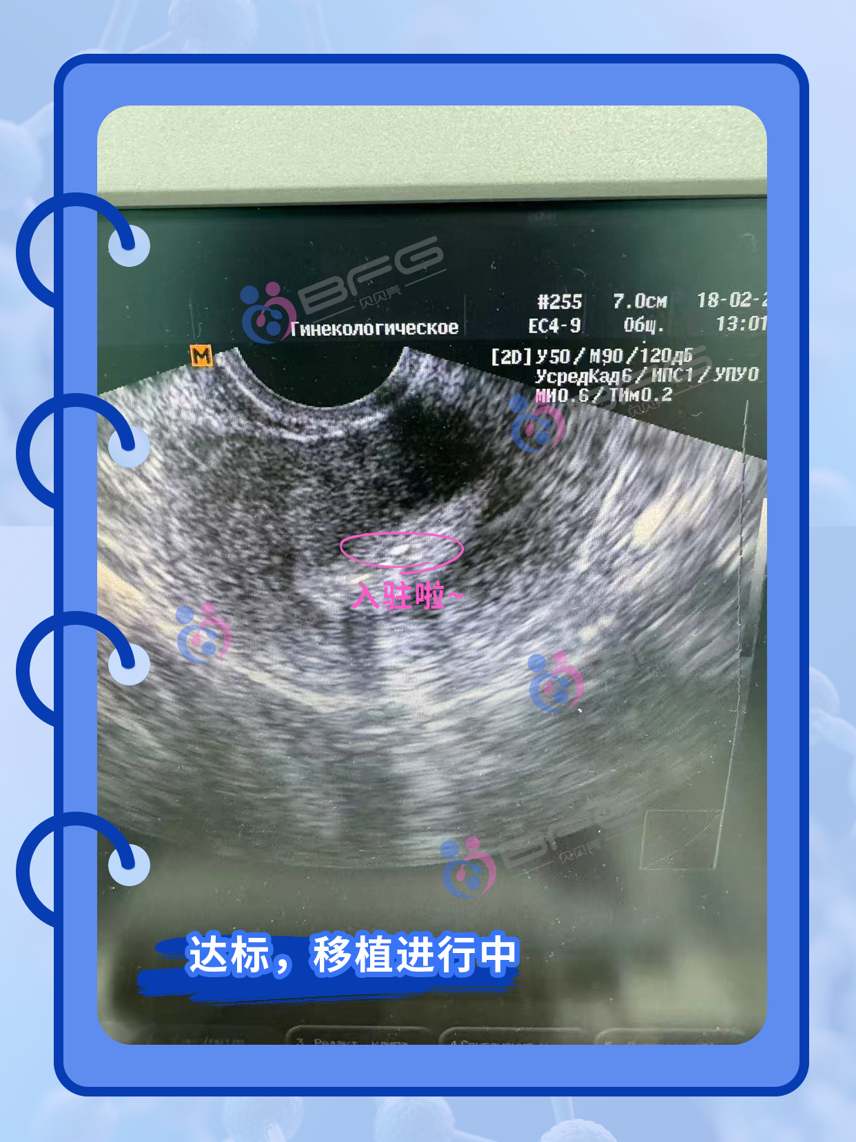 BFG助孕|科学调理内膜，提高抱娃率