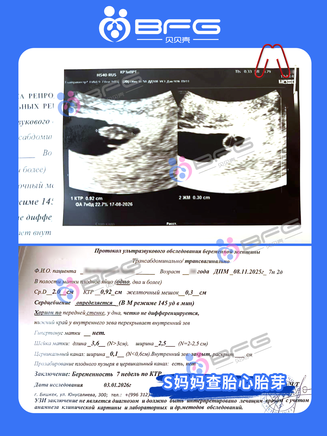 BFG助孕 | 2026年的第一声咚咚心跳
