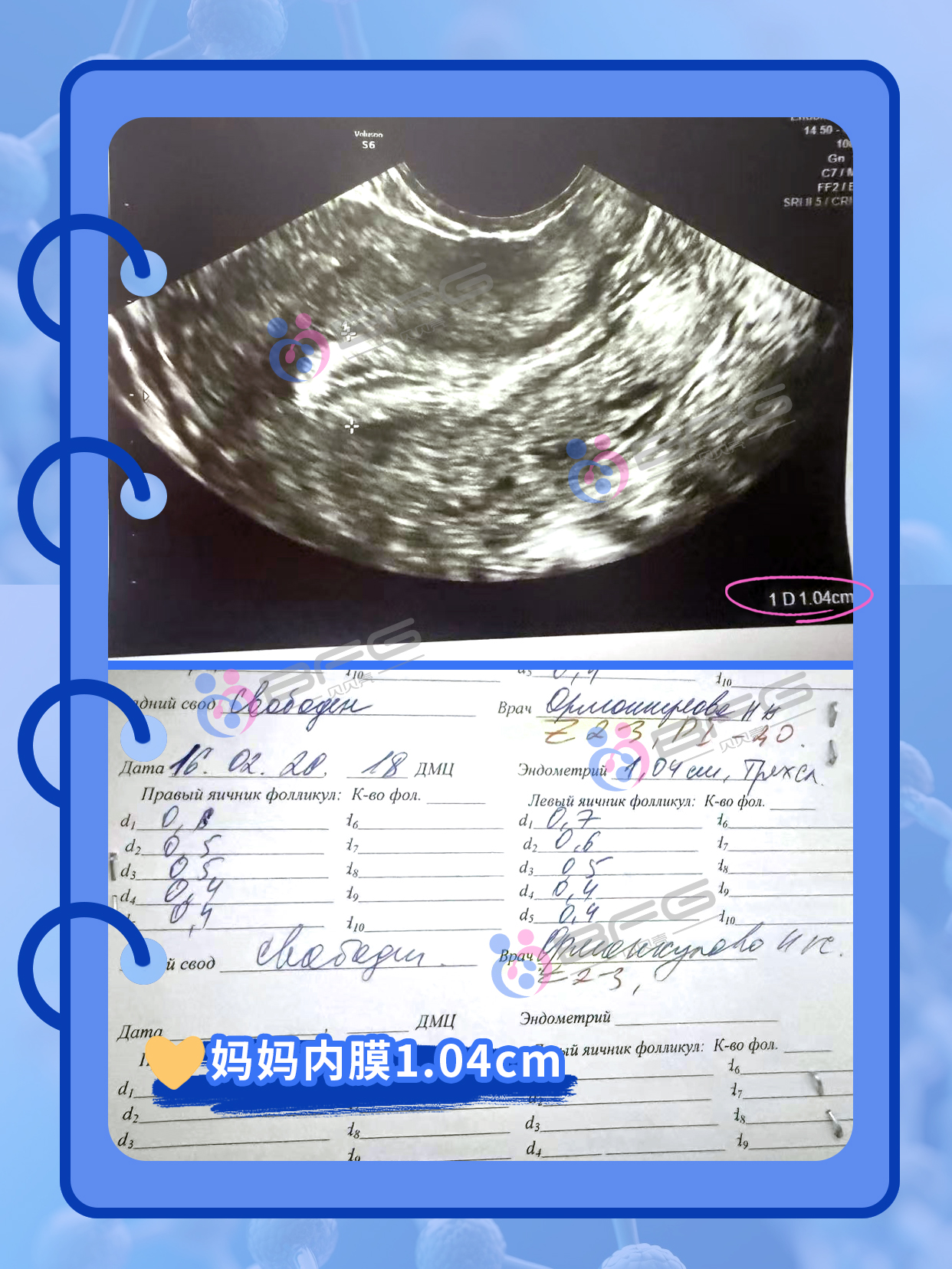 BFG助孕|科学调理内膜，提高抱娃率