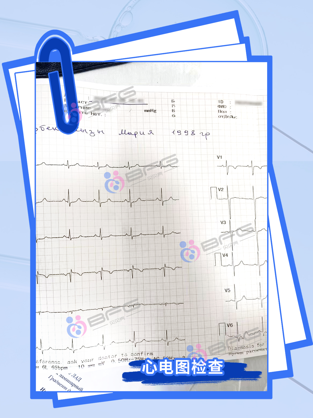 BFG助力家庭圆满