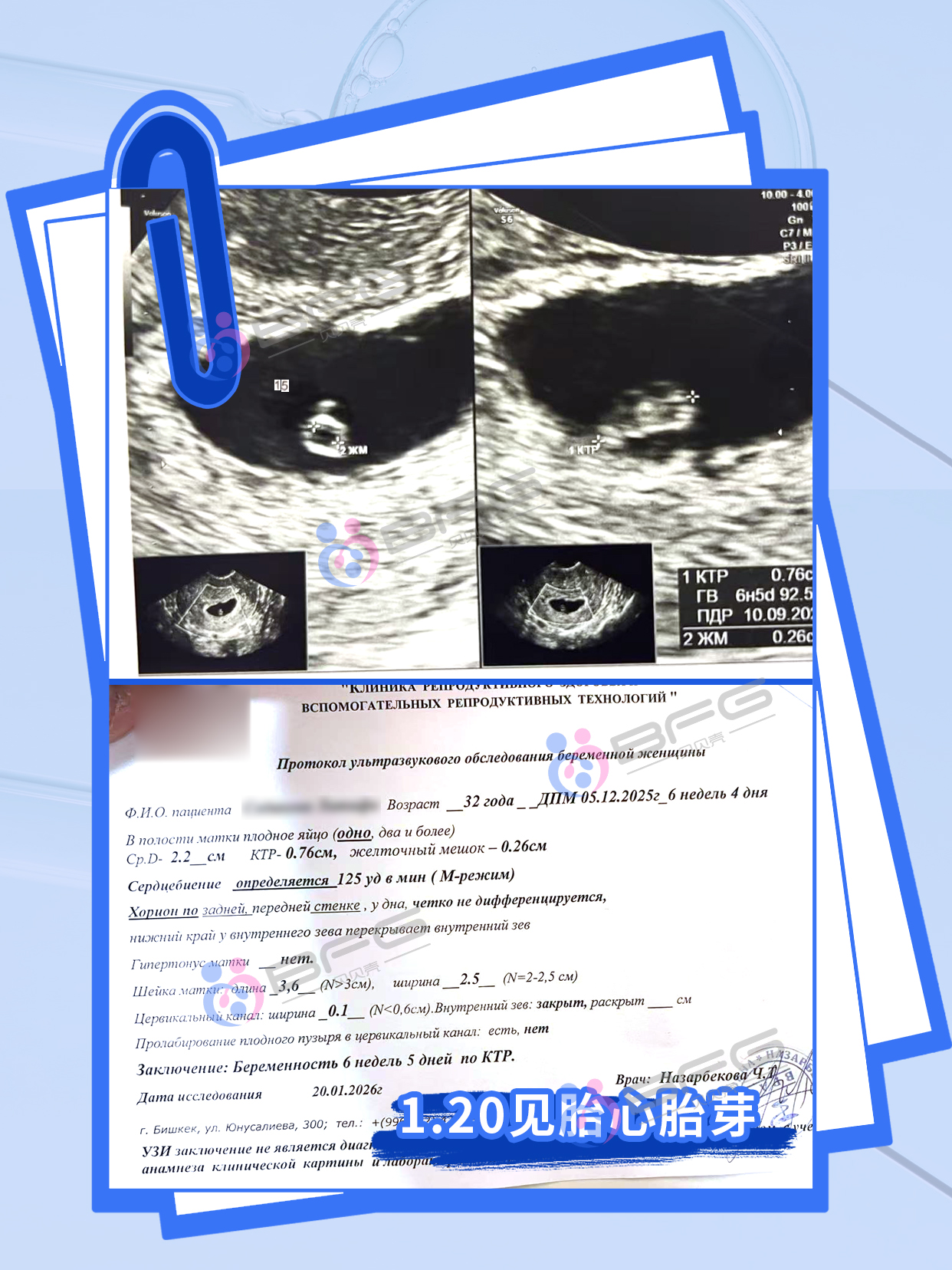 BFG助孕|新的心跳，带来家庭的圆满