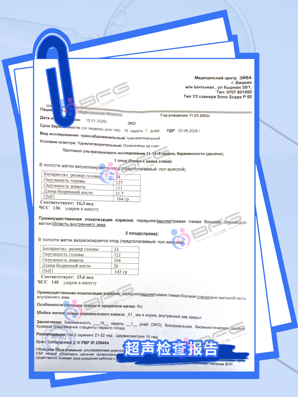 BFG助孕|“女子”事成双~龙凤胎宝宝16周啦~