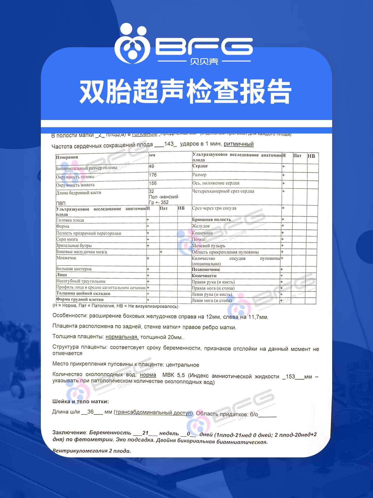 BFG助孕|马+马=騳(du)