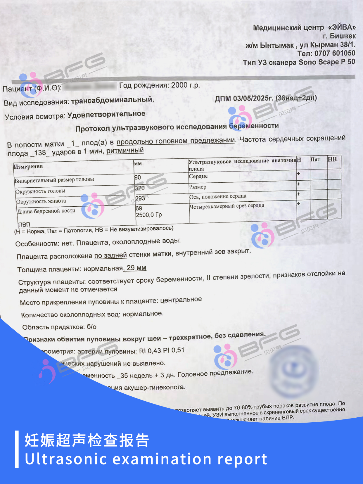 BFG助孕 | 和宝宝见面倒计时，期待~