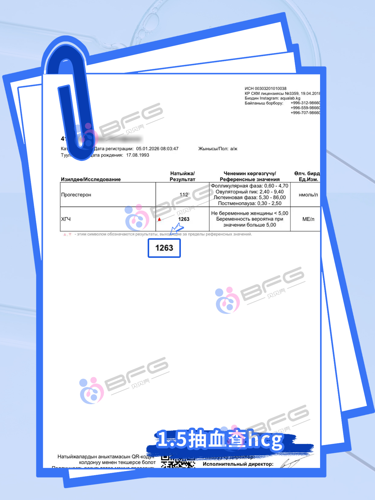 BFG助孕|新的心跳，带来家庭的圆满