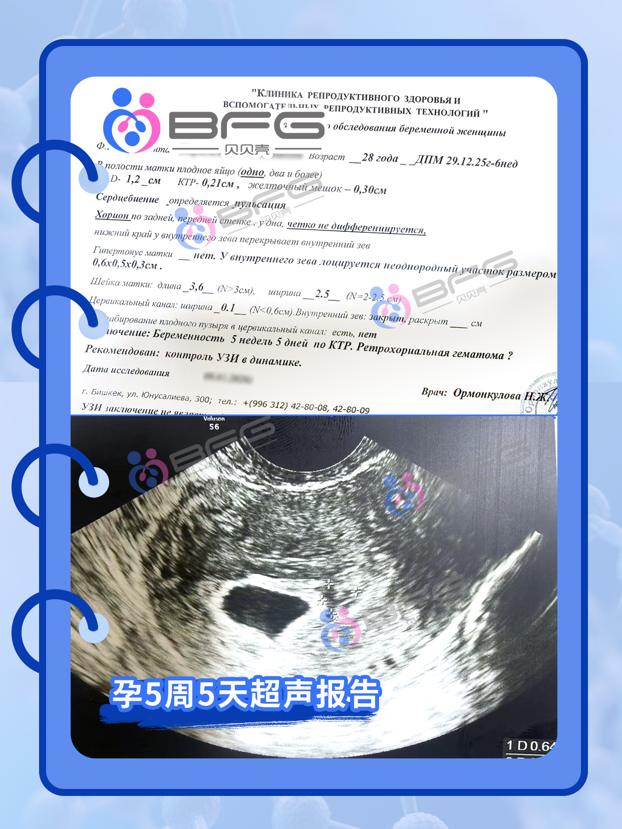 BFG助孕|好孕气，马上得“宝”