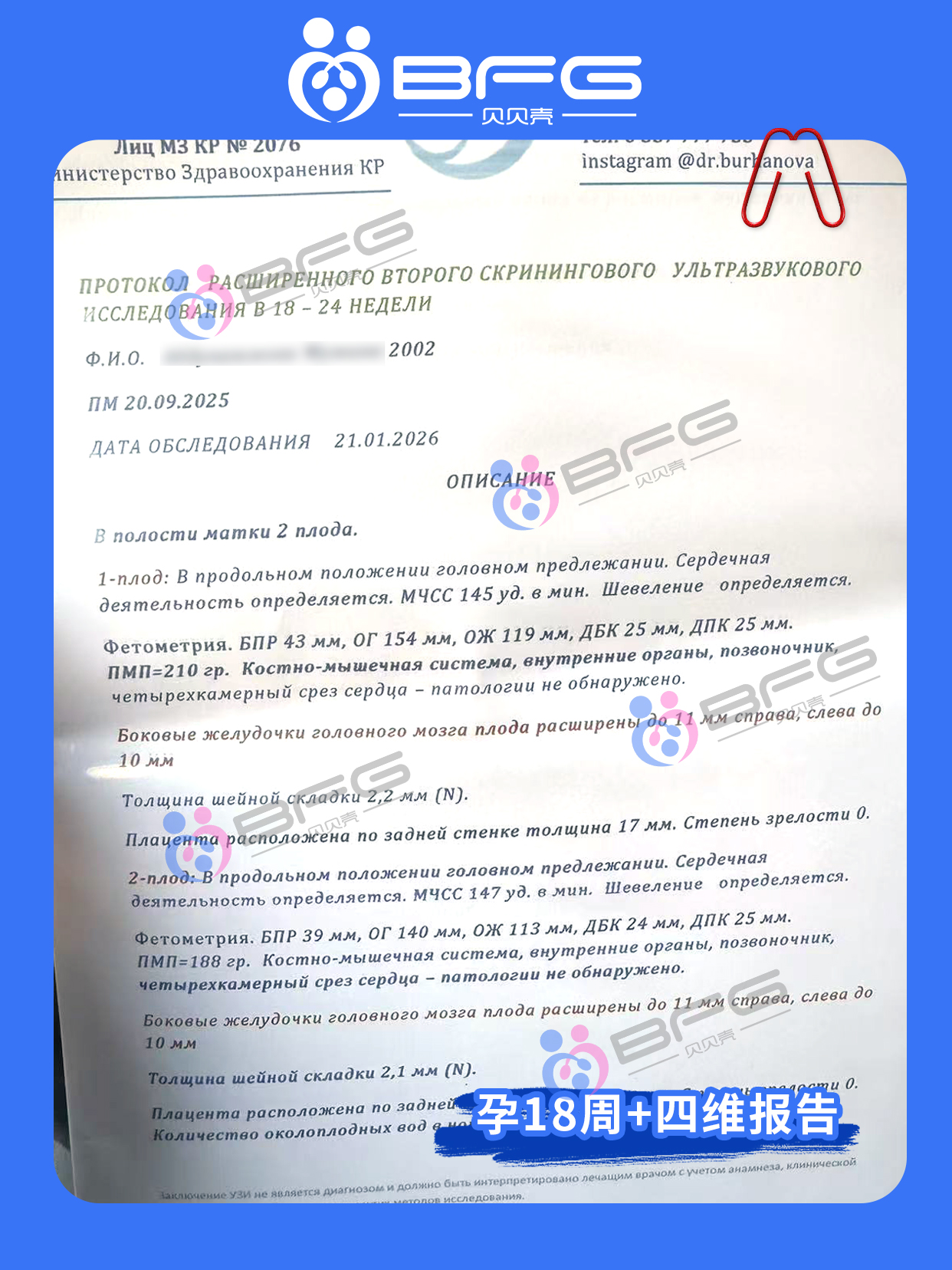 BFG助孕|四维通过，期待与两个宝宝的初见