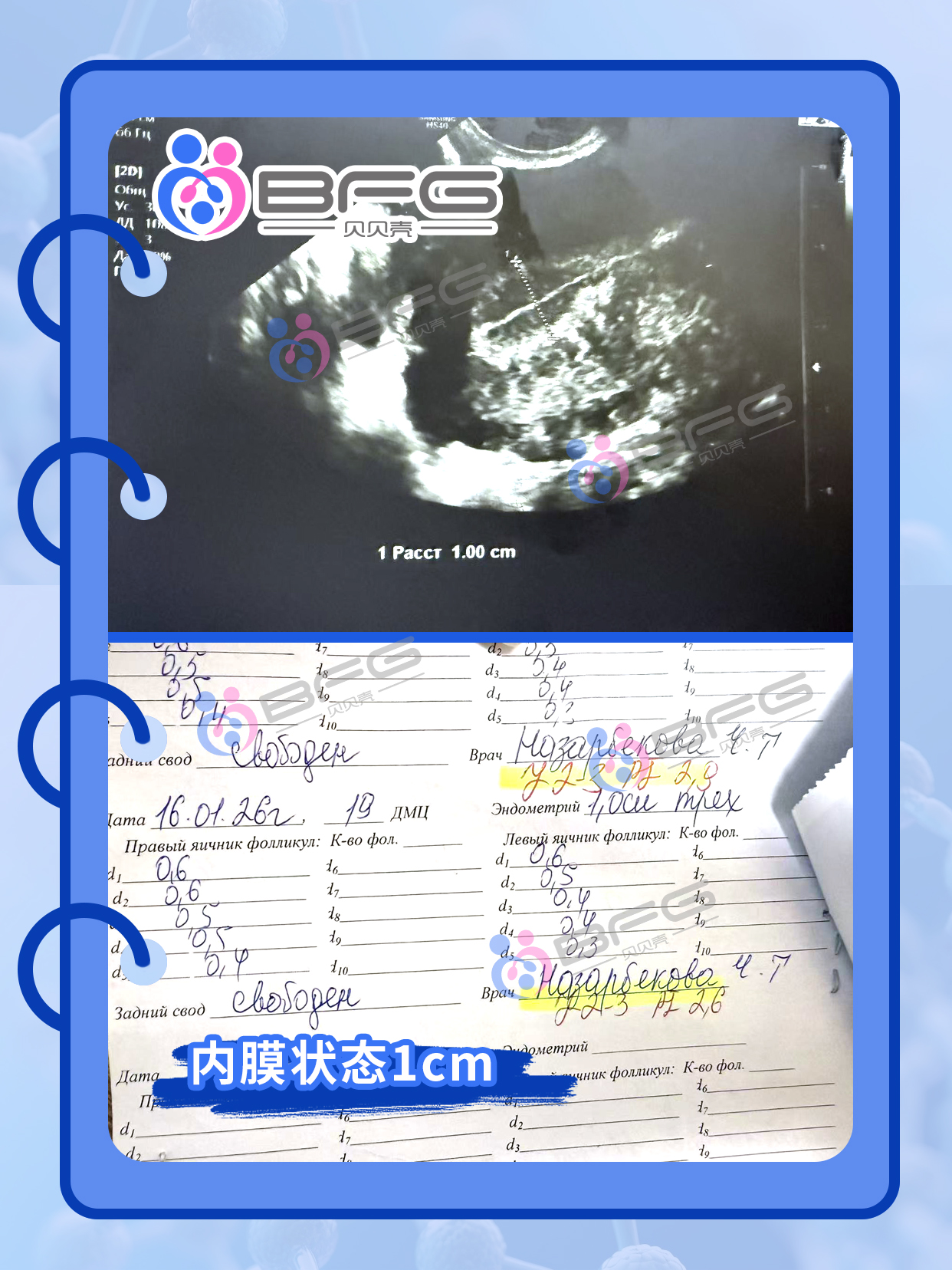 BFG助孕|移植时间定了，S夫妇心也定下来了