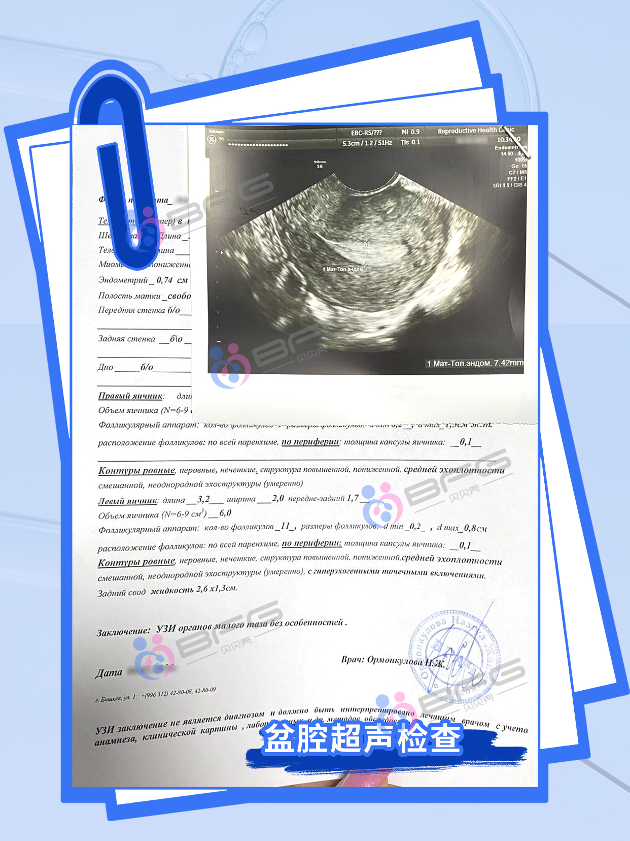 BFG助力家庭圆满