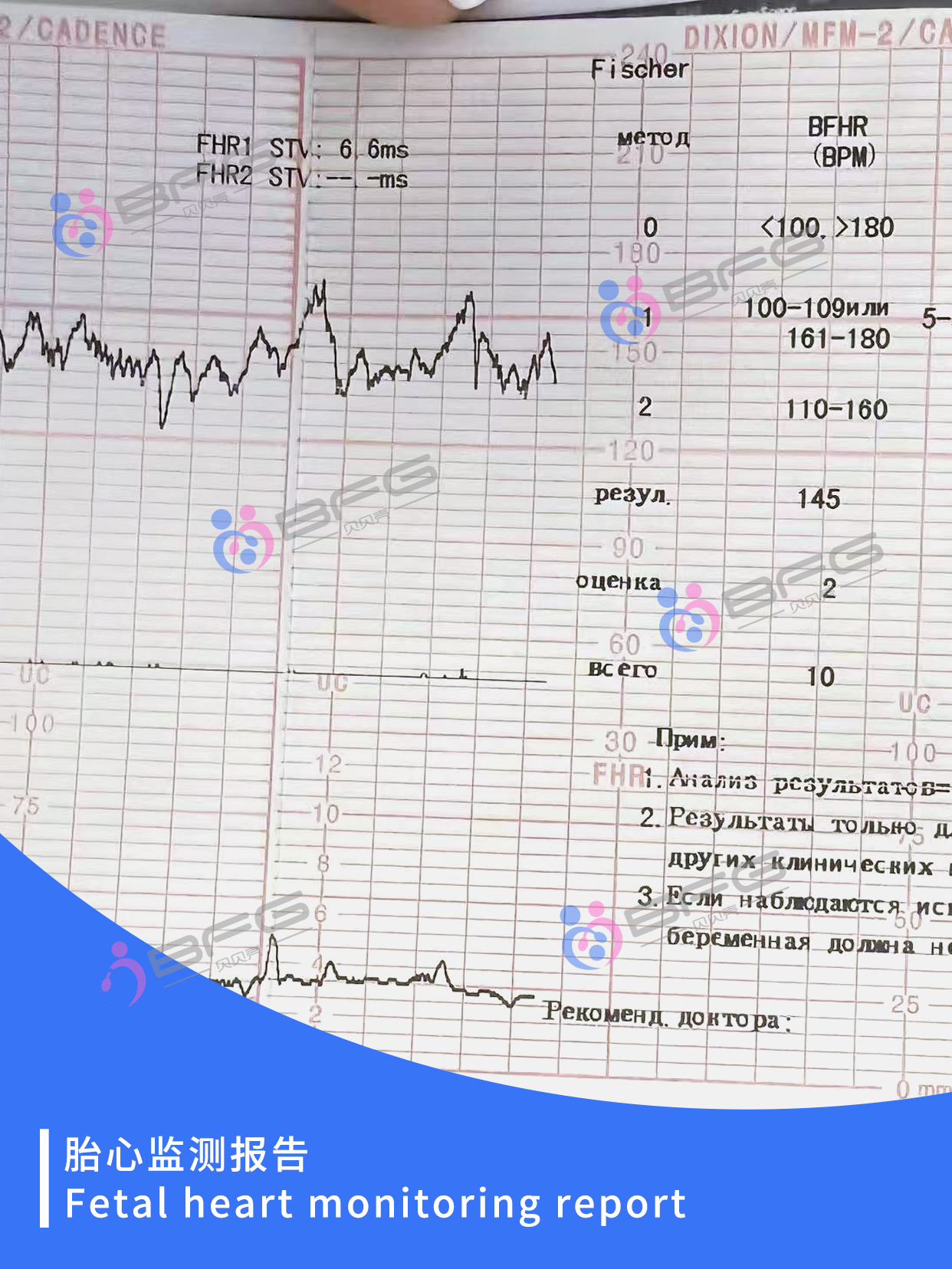 BFG助孕 | 和宝宝见面倒计时，期待~