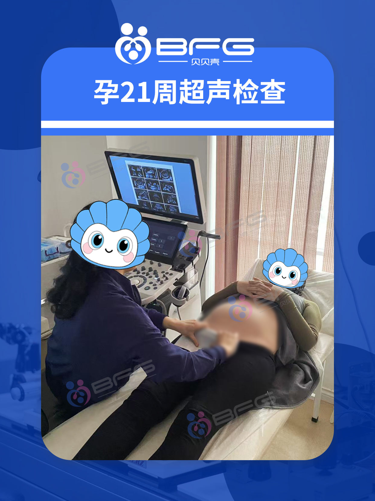 BFG助孕|马+马=騳(du)