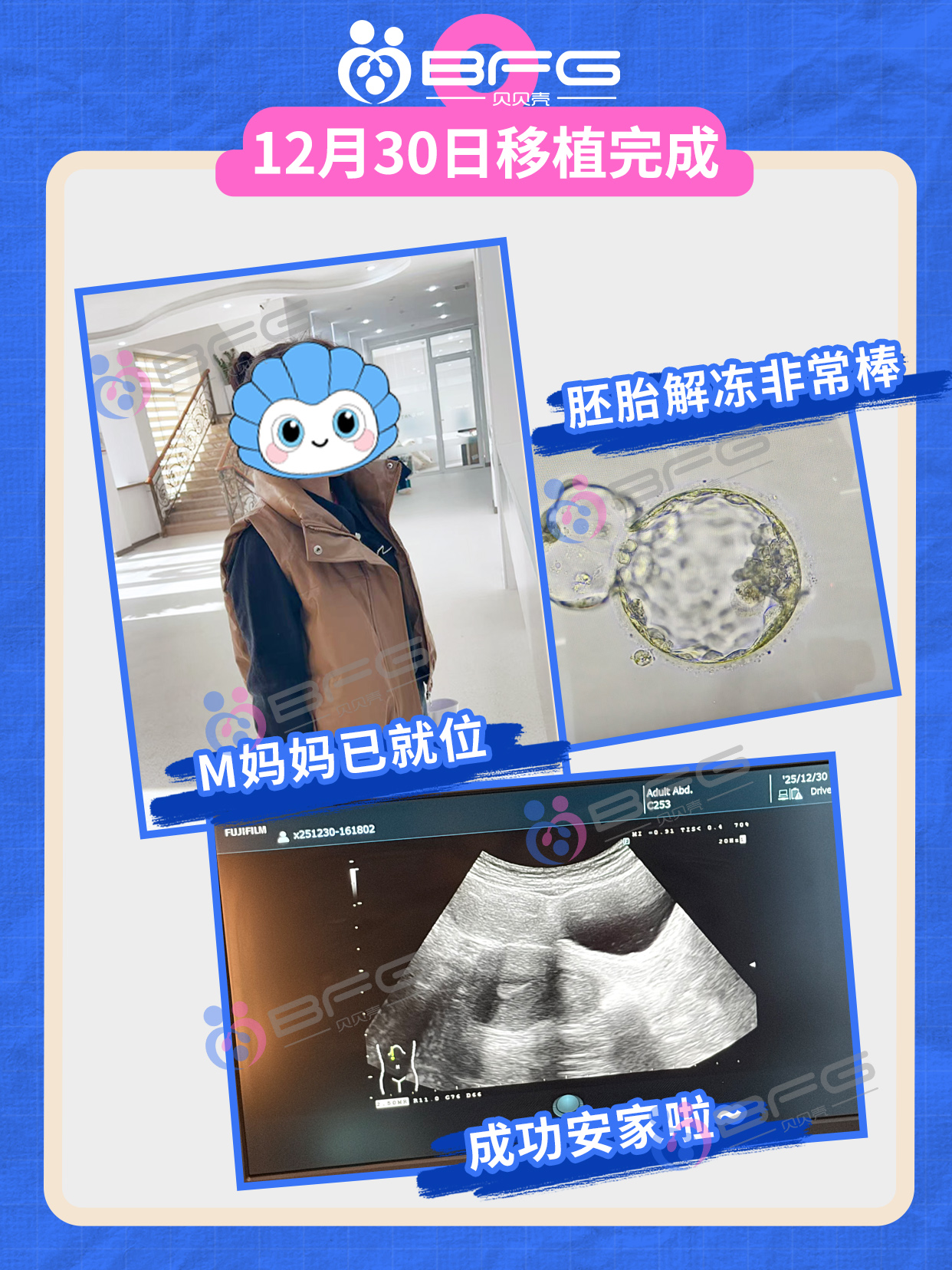 快看！BFG吉国的抱娃速度