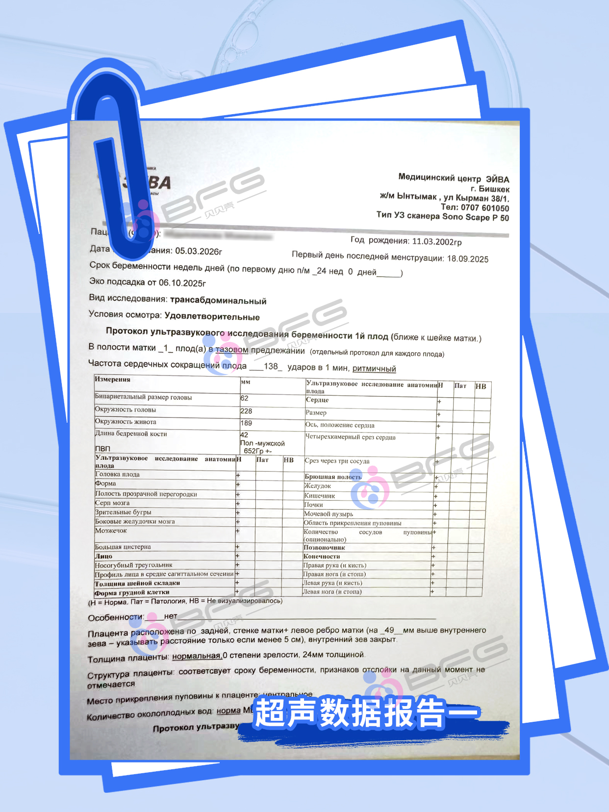 BFG助孕|龙凤宝宝，茁壮成长