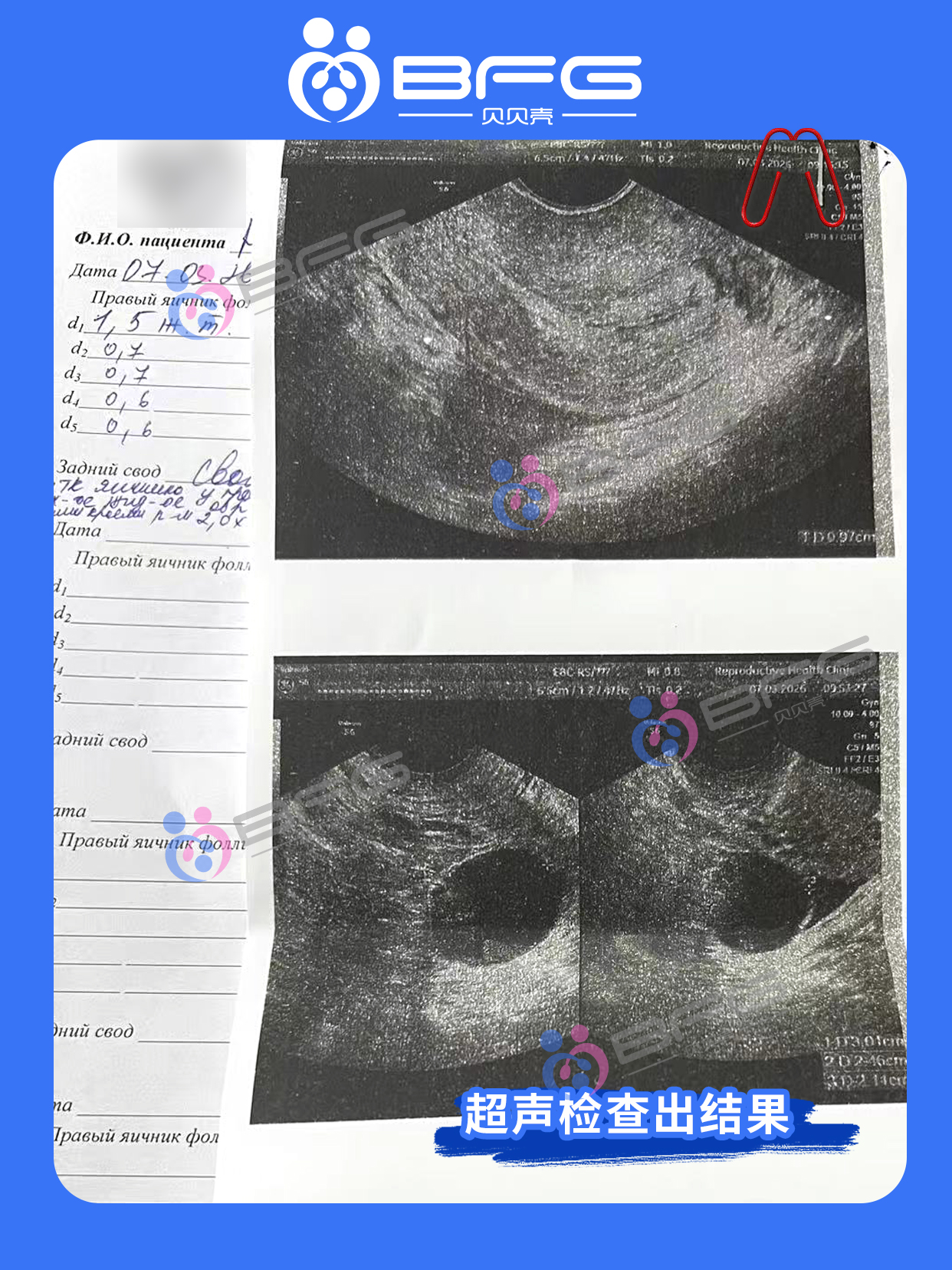 BFG助孕|全科会诊 准备好孕
