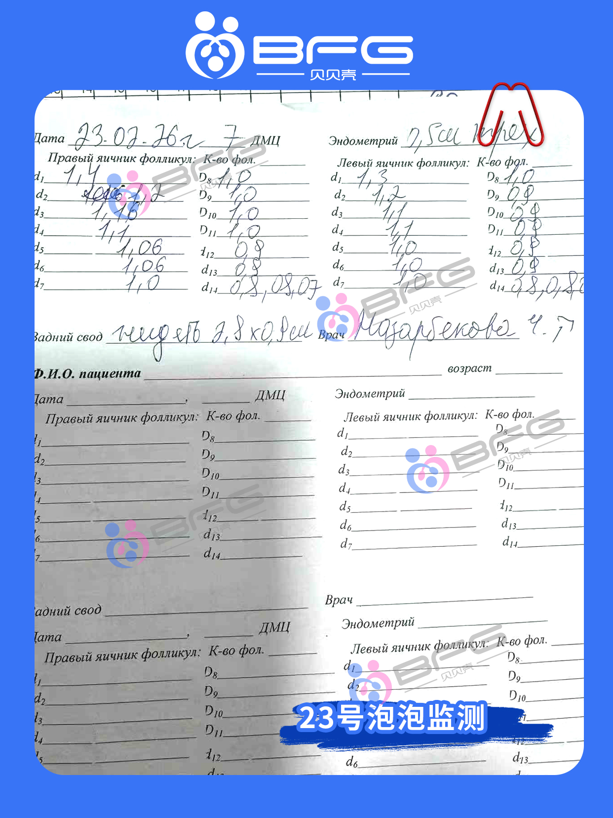 BFG吉国|漂亮妹妹助孕进行时……