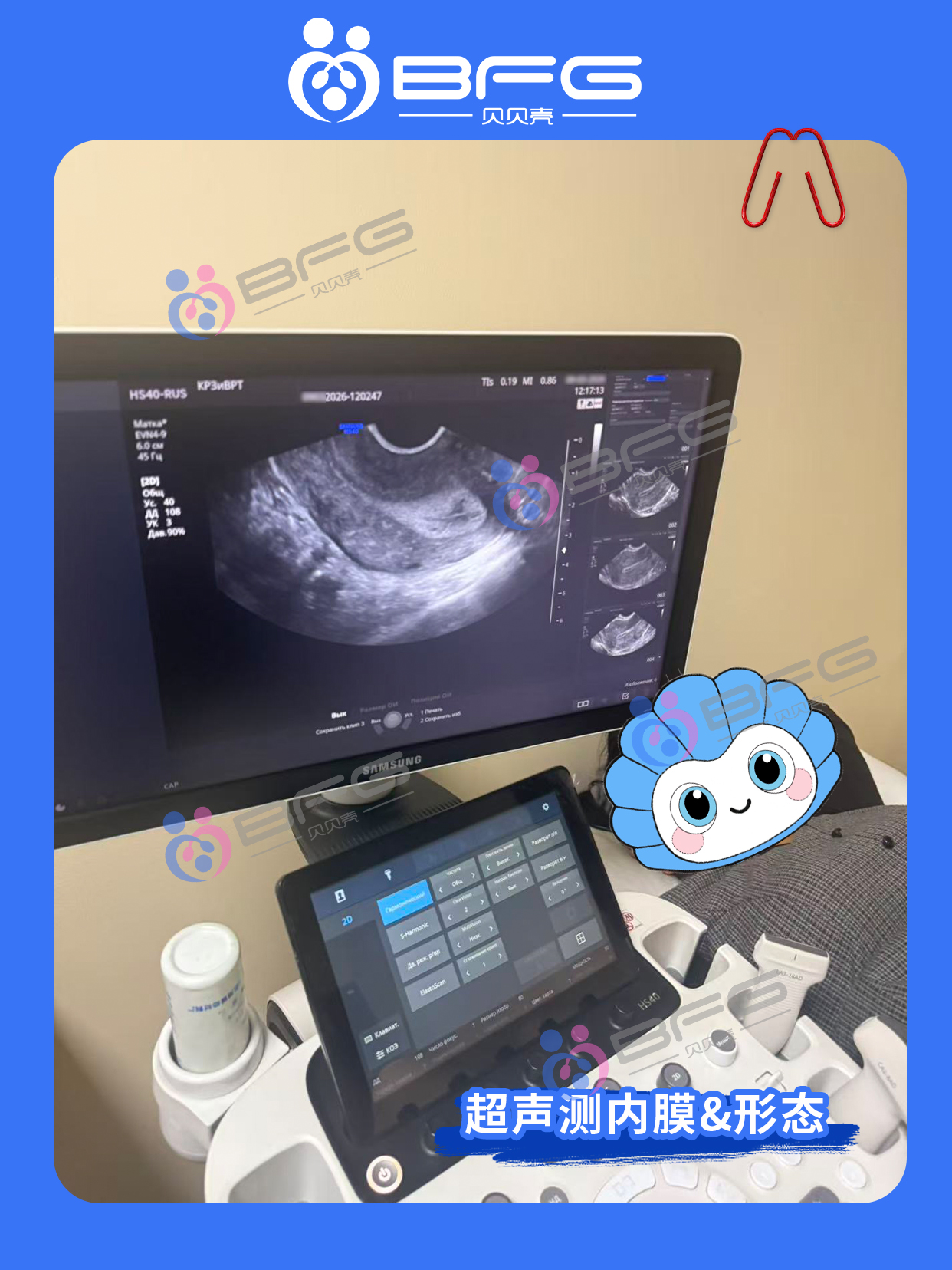 BFG助孕|全科会诊 准备好孕