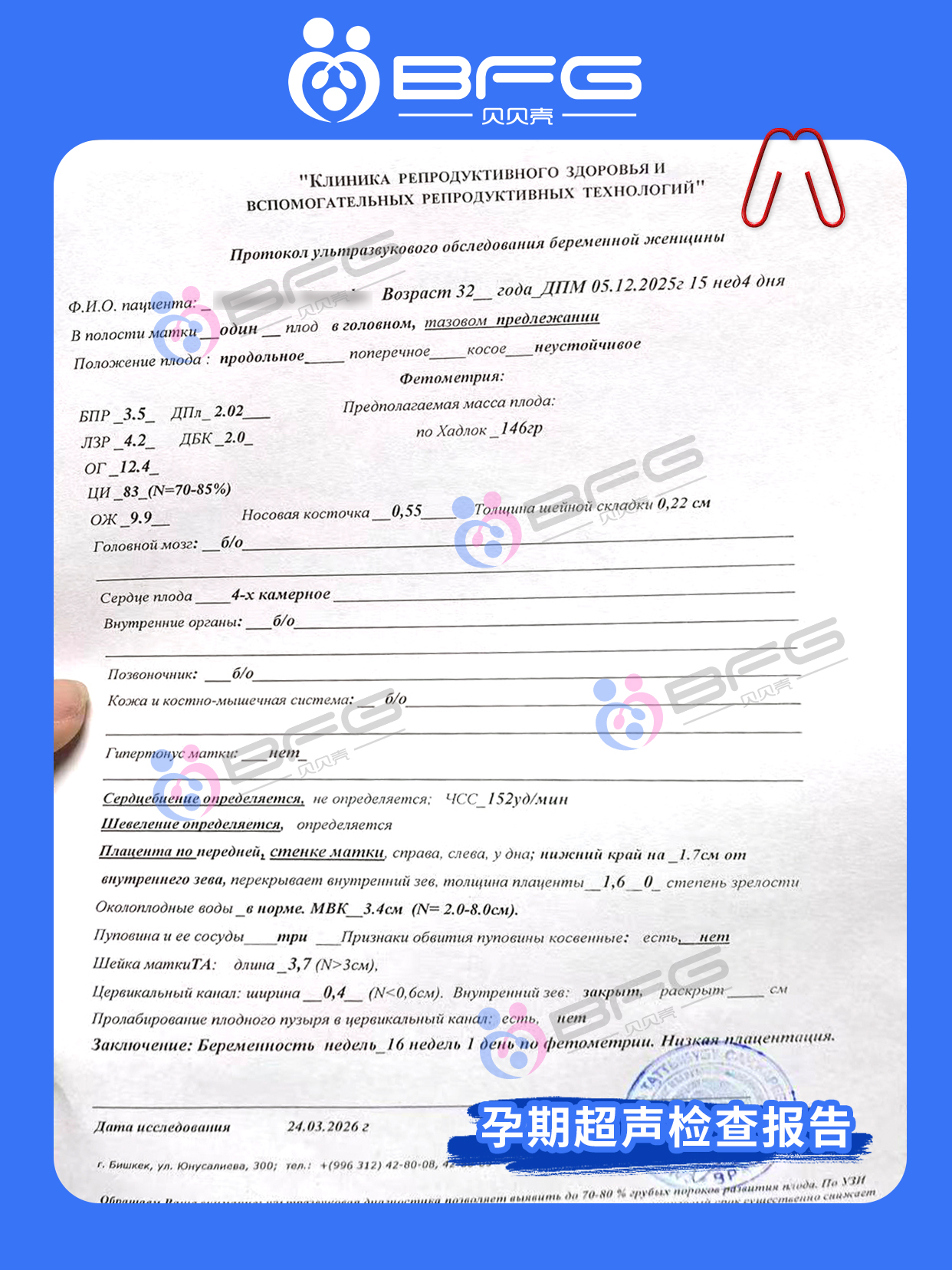 BFG助孕|3位❤妈妈，孕期三部曲