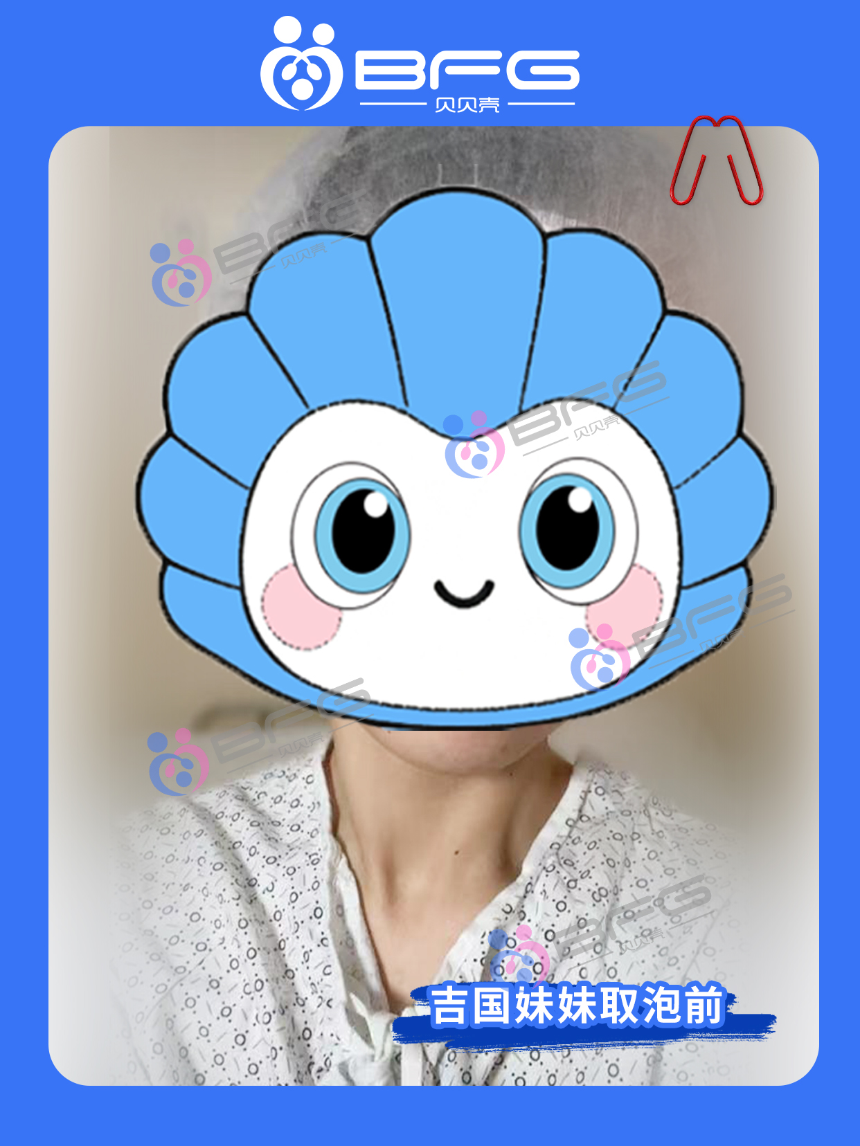 BFG吉国|漂亮妹妹助孕进行时……