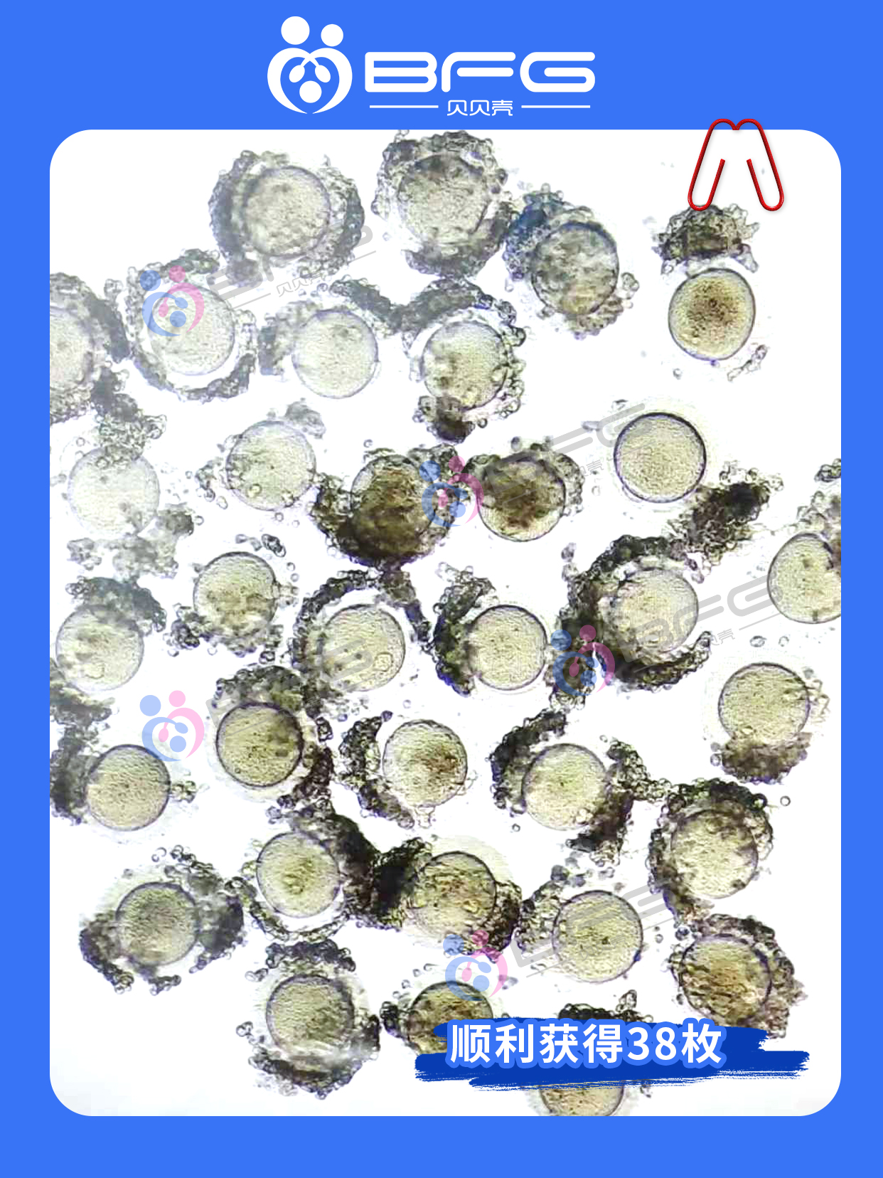 BFG助孕|可爱系妹妹助孕进行时