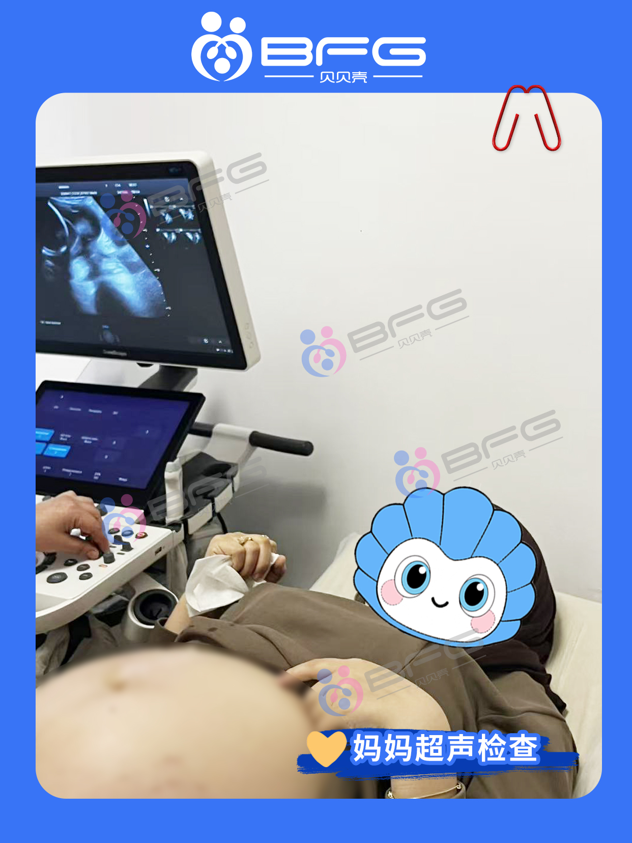 BFG助孕|孕30周，“家庭”即将圆满