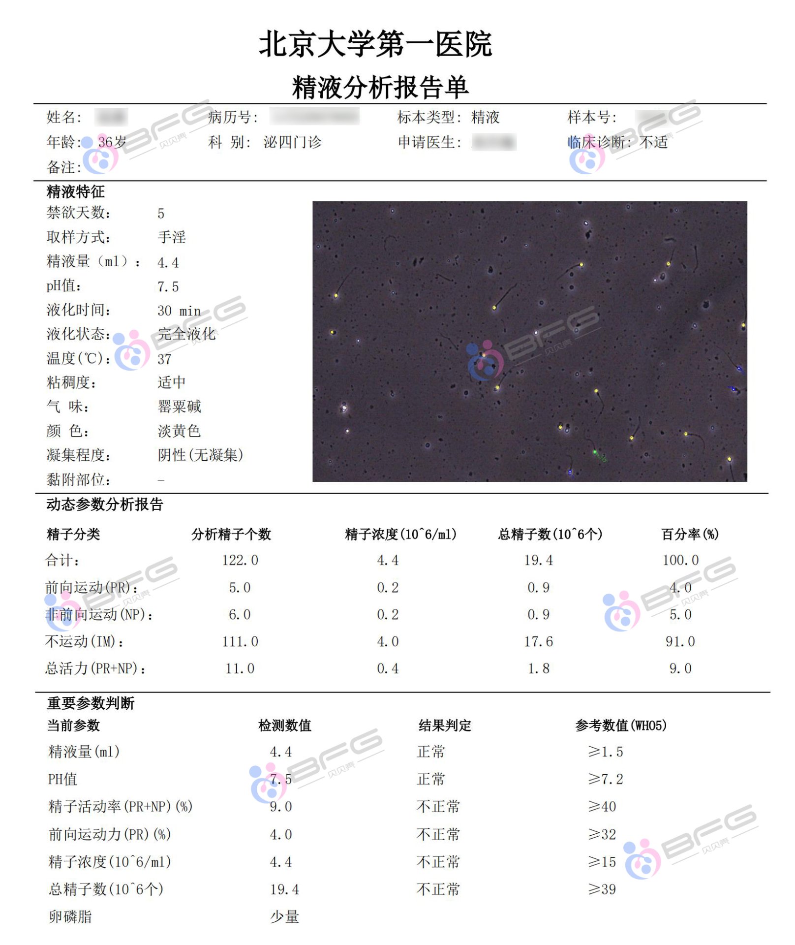 精子差也能一把过:独苗胚胎的家庭做到了插图2 精子差也能一把过:独苗胚胎的家庭做到了